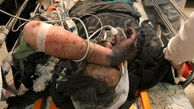 انفجار کیف پر از نارنجک دستی در قم / سوختگی شدید 3 برادر زیر 20 سال