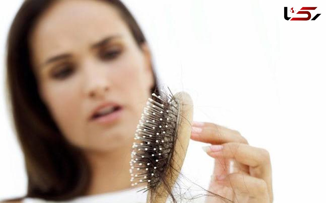 3 ریزش موی رایج در میان زنان/تغییرات هورمونی با ریزش مو در ارتباط است