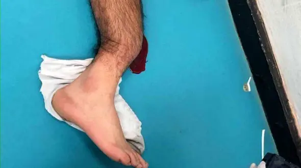 مصدومیت وحشتناک گومز در بازی مقابل تاتنهام + فیلم و عکس