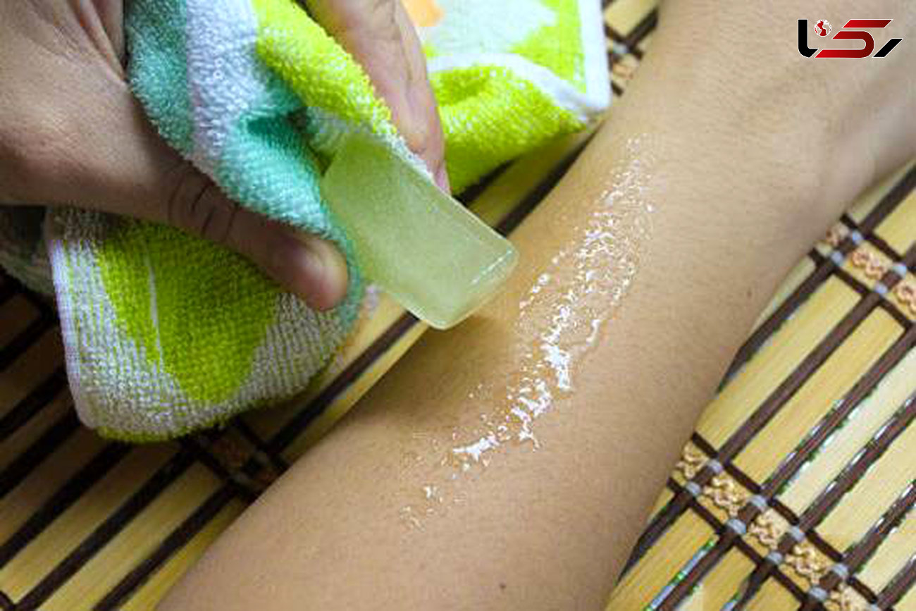 درمان فوری آفتاب سوختگی با شیر خنک