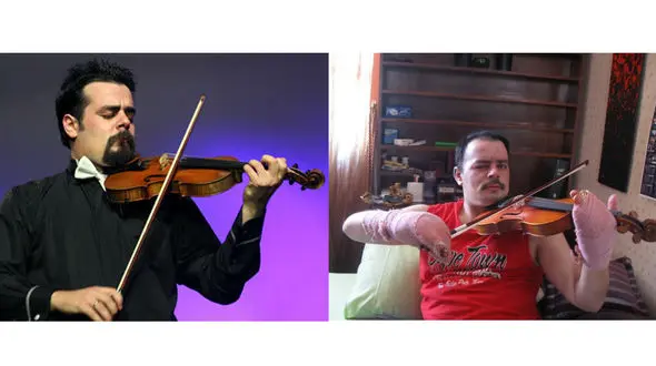 نوازنده ویولون ایرانی پس از سوختگی دست و صورتش به صحنه بازگشت+ عکس