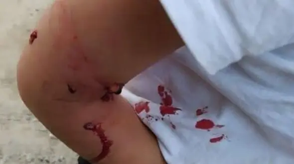 سگ ها یک دختر بچه زنجانی را تکه پاره کردند!