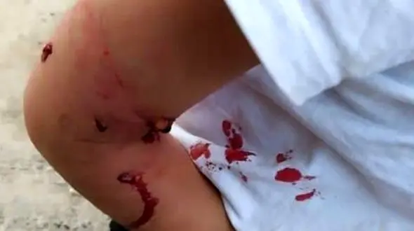 سگ ها یک دختر بچه زنجانی را تکه پاره کردند!