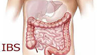 بین 10 تا 20 درصد از جمعیت کشور به IBS مبتلا هستند / زنان بیش از مردان به سندرم روده تحریک پذیر دچار می شوند