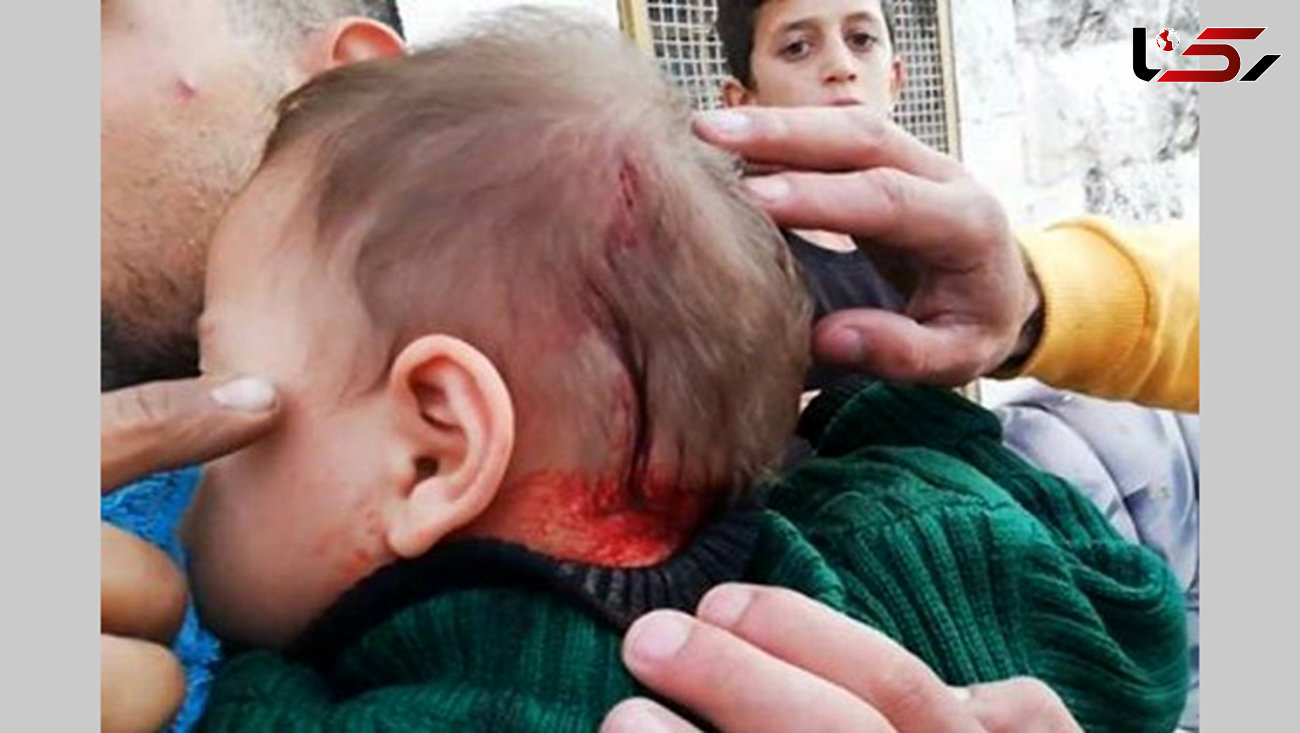 زخمی شدن نوزاد فلسطینی در حمله به منازل فلسطینی‌ها