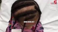شکنجه عجیب یک دختر در مهدکودک / موهایش را تراشیدند+فیلم