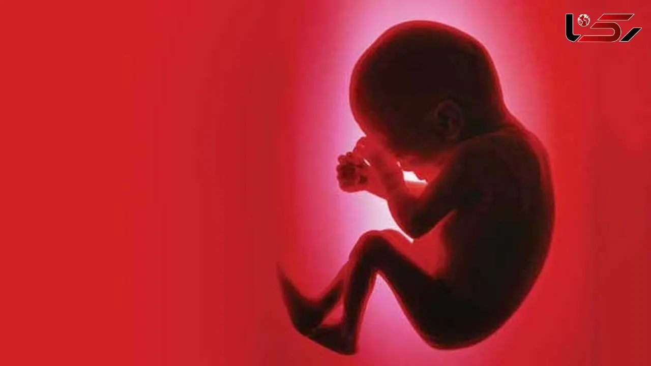 واقعی و تکاندهنده / جنین سه ماهه در شکم پسر 7 ساله / پزشکان مبهوت شدند