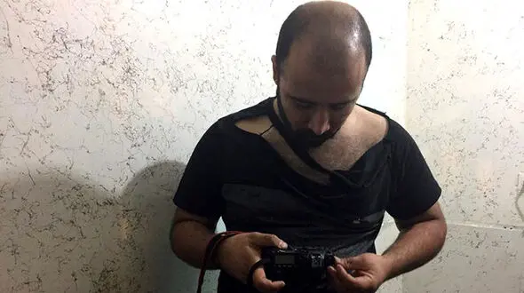 حمله  شهرداریچی ها به یک عکاس خبرنگار + تصویر