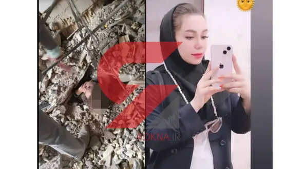 عکس جدید دختر نجات یافته از فاجعه متروپل ! / خنده هایی که تلخ است !