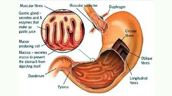 ترش کردن معده + درمان