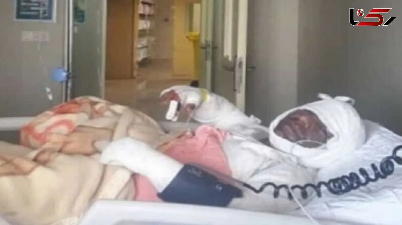 بستری شدن ۳۰ هزار نفر بخاطر سوختگی در ایران/ سالانه 2 هزار نفر دچار برق گرفتگی می شوند