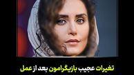 خانم بازیگران ایرانی که با جراحی از این رو به آن رو شدند / فیلم تغییرات چهره که باور نمی کنید!