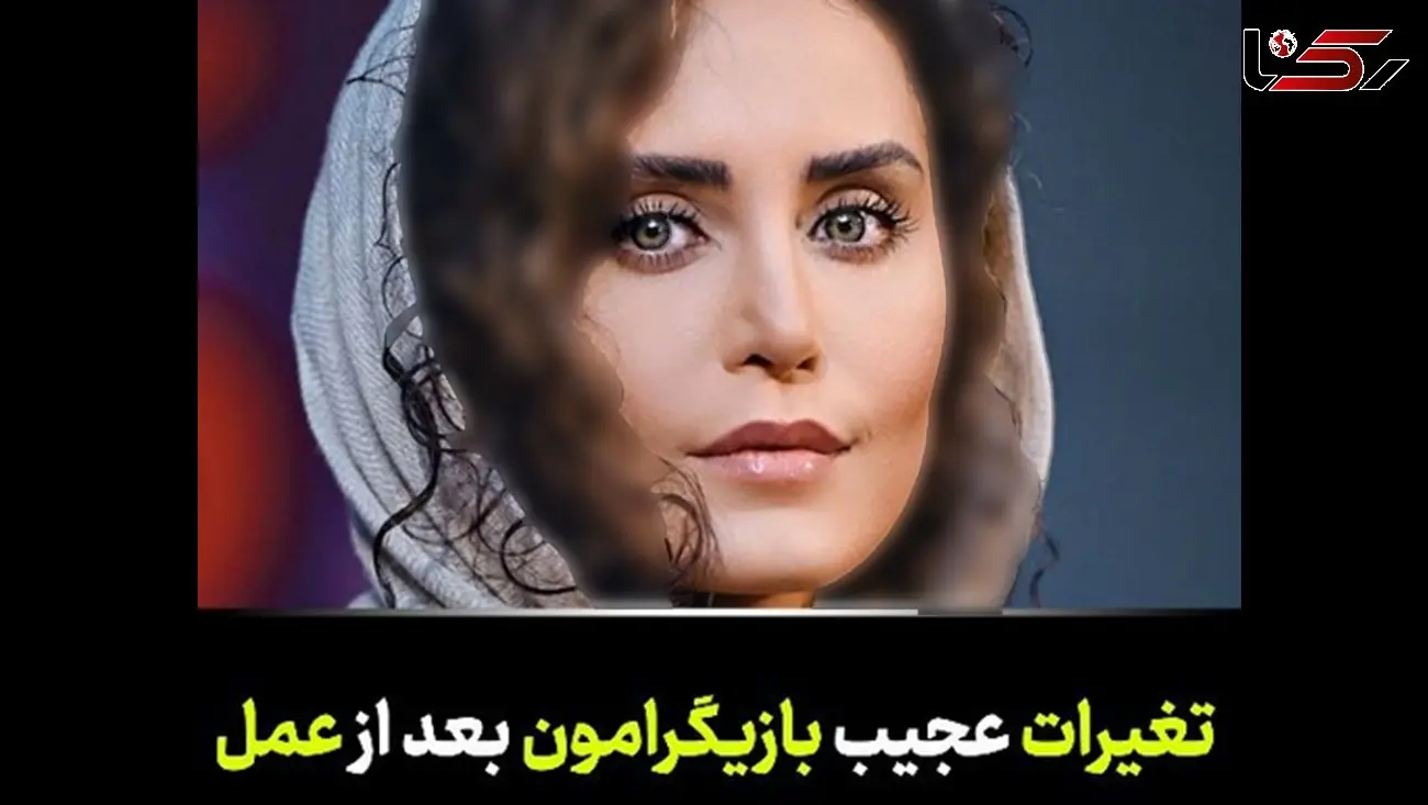 خانم بایگران ایرانی که با جراحی از این رو به آن رو شدند / فیلم تغییرات چهره که باور نمی کنید!