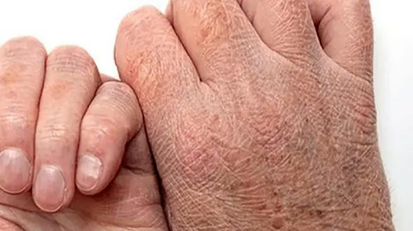 طول درمان چیست و چگونه می توان از آن استفاده کرد؟