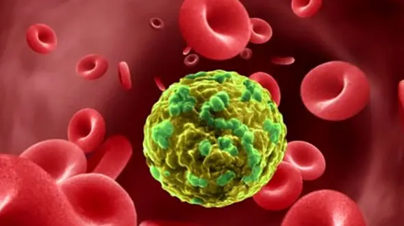 چرا 80 درصد مردم این روستا سرطان دارند؟!