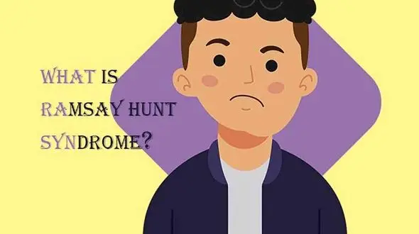 سندرم رامسی هانت چیست؟