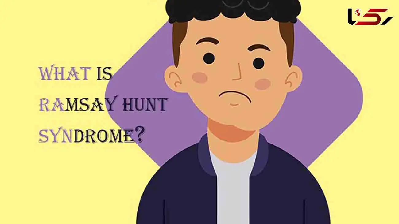 سندرم رامسی هانت چیست؟