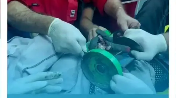 دست کارگر جوان با کمباین قطع شد/به همراه فیلم و عکس