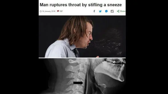 اتفاق وحشتناک برای یک مرد هنگام عطسه / انگلیس