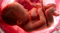 جزئیات طرح جدید مجلس برای سقط جنینی که مشکل جسمی یا ژنتیک دارد