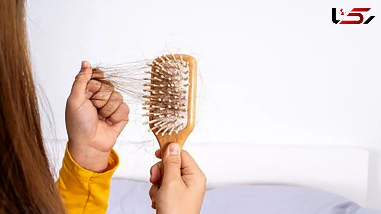 میزان ریزش مو تا چه حد طبیعی است؟