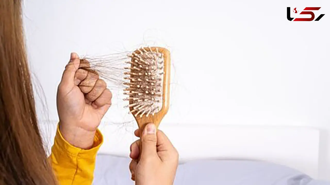 میزان ریزش مو تا چه حد طبیعی است؟