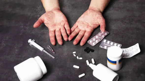 علت اصلی گرفتگی بینی در فصل بهار چیست؟ راهکارهایی برای درمان فوری!