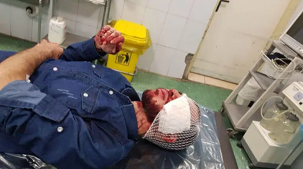 فیلم لحظه به لحظه شکافته شدن صورت جوان تهرانی توسط 3 زورگیر ماسک دار 
