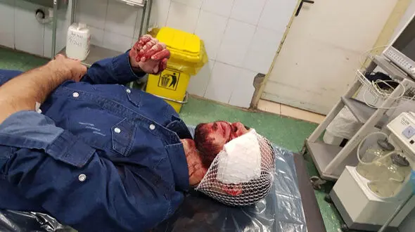 فیلم لحظه به لحظه شکافته شدن صورت جوان تهرانی توسط 3 زورگیر ماسک دار 