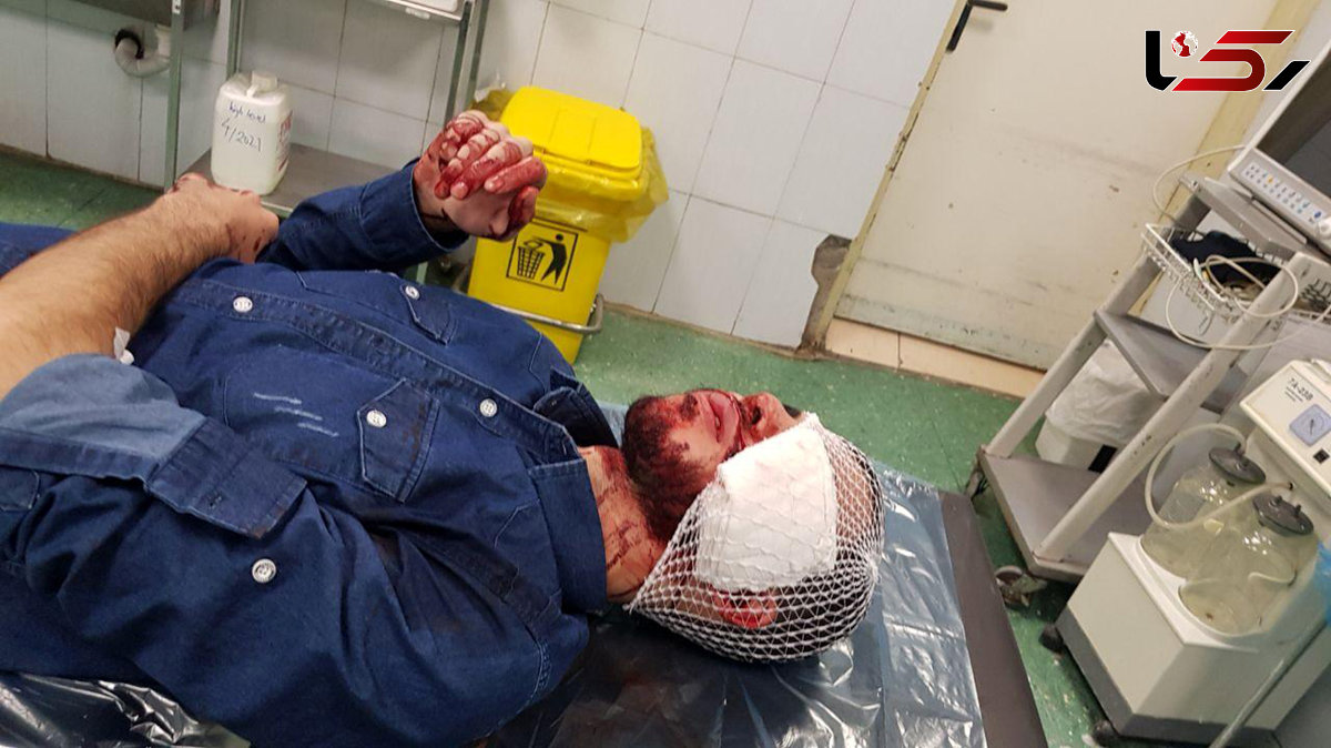 فیلم لحظه به لحظه شکافته شدن صورت جوان تهرانی توسط 3 زورگیر ماسک دار 