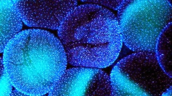 مکانیسم مولکولی بیماری پارکینسون کشف شد