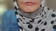 مرد مشهدی لب‌های زن ۱۸ ساله‌اش را دوخت /  فائزه به کلانتری پناه برد + عکس 