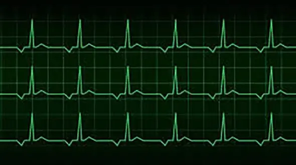 خطرات تپش قلب