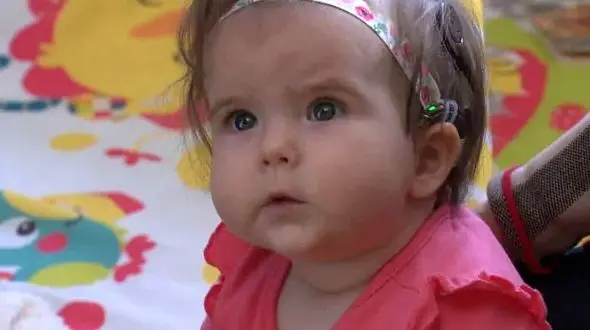 نصب سمعک برای کودکی که تاکنون صدای پدر و مادرش را نشنیده بود+عکس