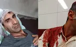 حمله وحشیانه 3 مسافر خشن به رانند تاکسی اینترنتی تهران + عکس های دلخراش