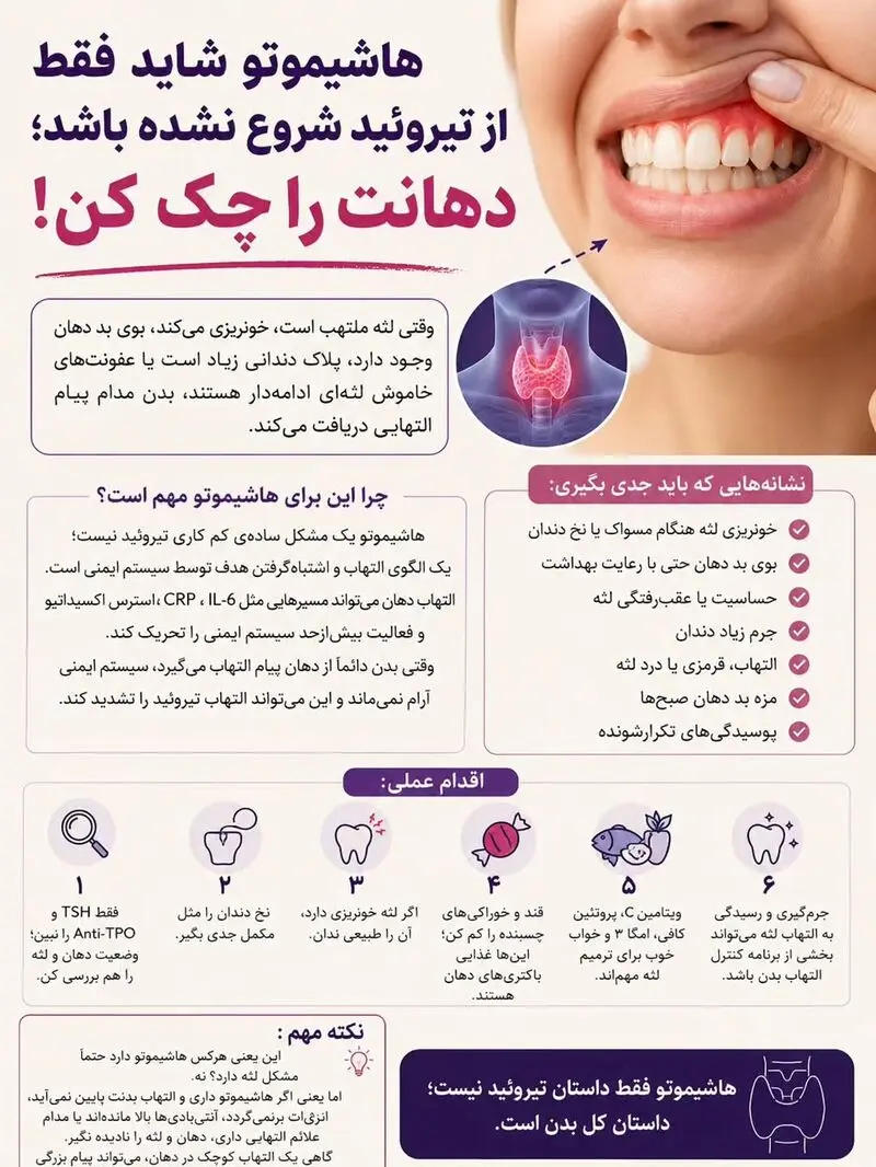 هاشیموتو