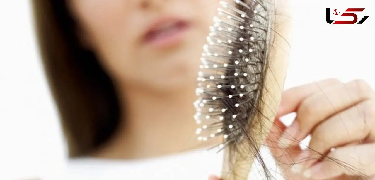 ریزش مو  شدید نشانه چه بیماری است؟