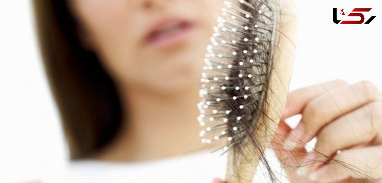 ریزش مو  شدید نشانه چه بیماری است؟