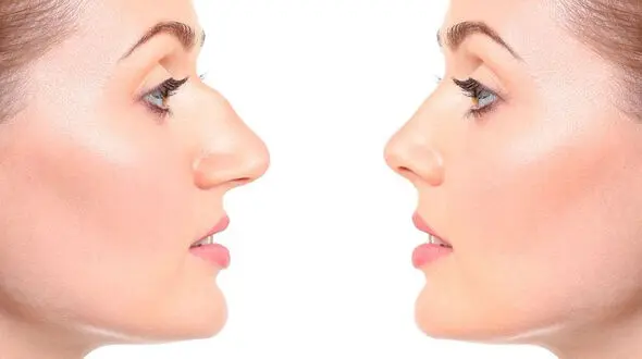 تیپ پلاستی چیست؟