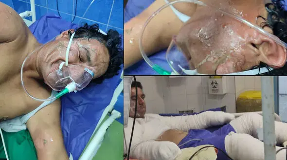 + 18 / بیایید نفری هزار تومان کمک کنیم تا این مرد فداکار ایرانی را نجات دهیم / تمام وجودش سوخت + عکس و فیلم