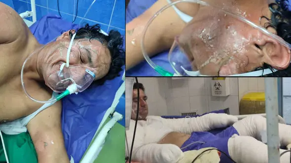 + 18 / بیایید نفری هزار تومان کمک کنیم تا این مرد فداکار ایرانی را نجات دهیم / تمام وجودش سوخت + عکس و فیلم