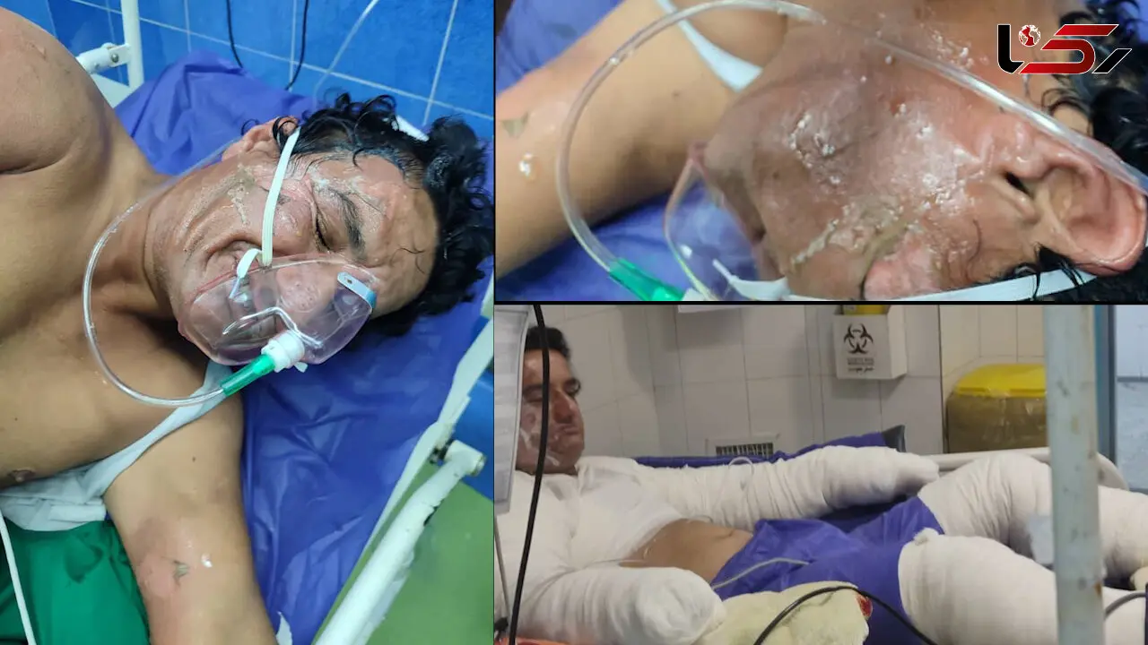 + 18 / بیایید نفری هزار تومان کمک کنیم تا این مرد فداکار ایرانی را نجات دهیم / تمام وجودش سوخت + عکس و فیلم