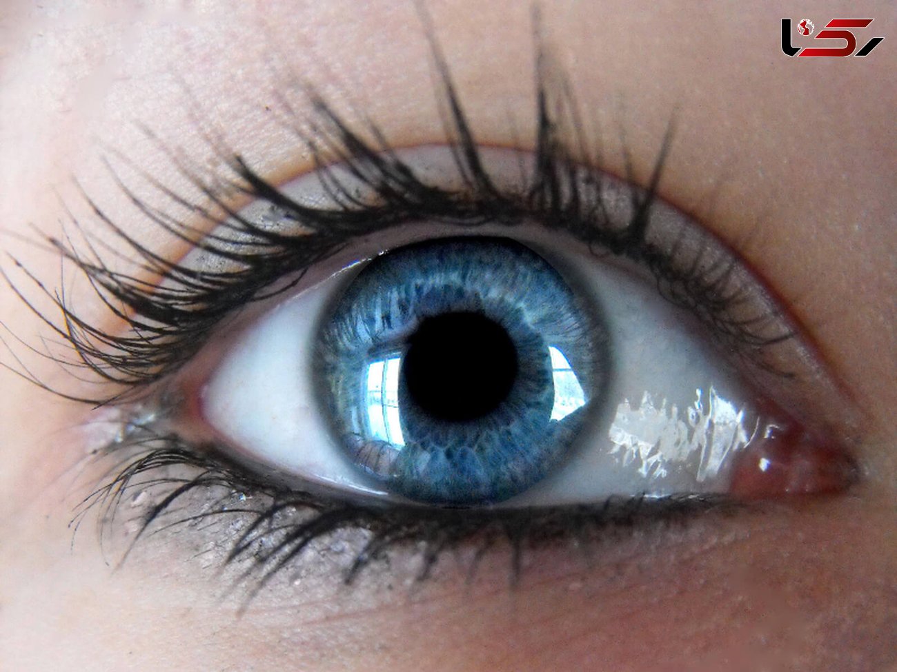 درمان خشکی چشم با ویتامین های مفید