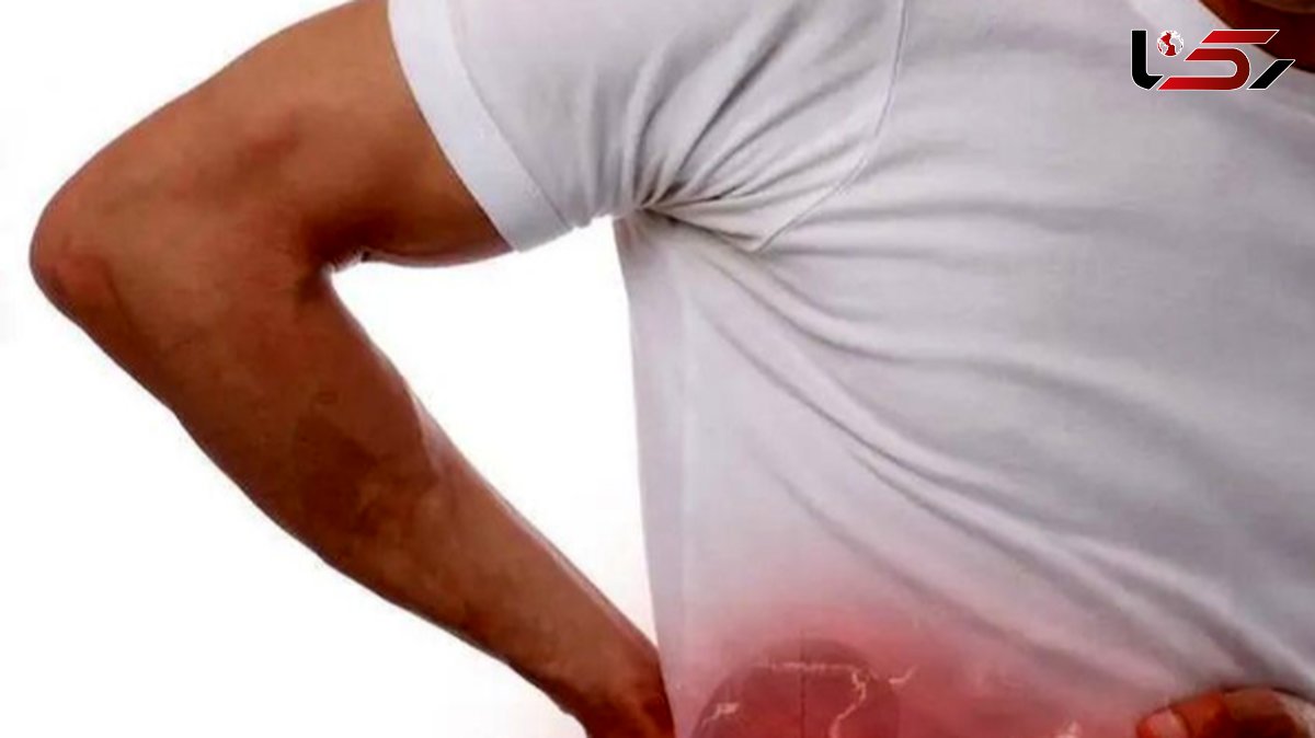 علل و عوامل ایجاد سنگ کلیه، نفخ و یبوست؛ نکاتی که باید بدانید