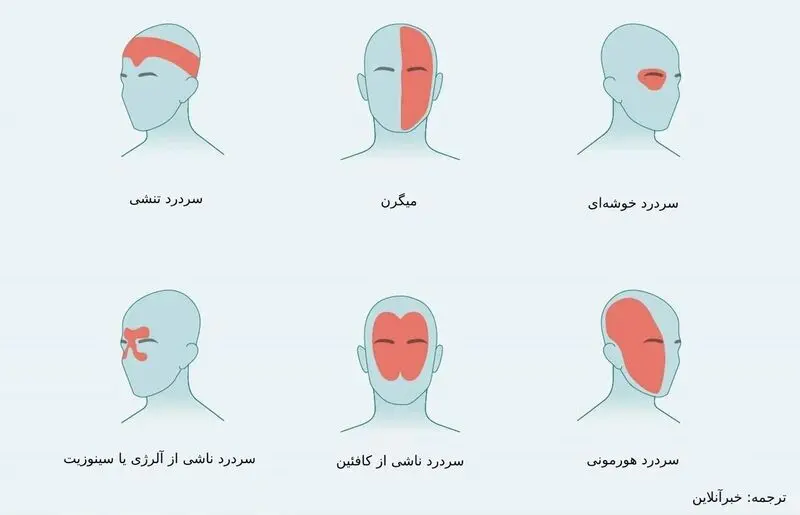 درد در نواحی مختلف سر ناشی از چیست؟/ از سردرد خوشه‌ای تا سردرد رعد و برقی+ تصاویر