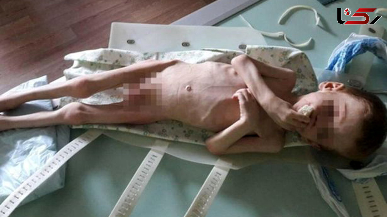 شکنجه کودک 4 ساله به دلیل رفتار پلید مادرش +عکس دلخراش 16+