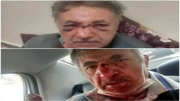 ماجرای درگیری ماموران شهرداری با پیرمرد تبریزی چه بود؟/ شهردار فاش کرد 