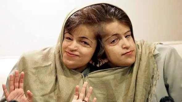 عکس سفر در زمان /  ‌یادی کنیم از دوقلوهای به‌هم چسبیده لاله و لادن و عکس دیده نشده از فروغ فرخزاد و تهران قدیم ...