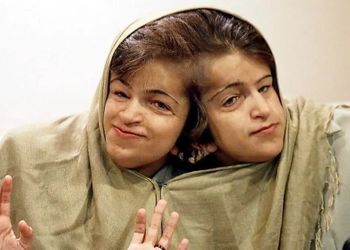 عکس سفر در زمان /  ‌یادی کنیم از دوقلوهای به‌هم چسبیده لاله و لادن و عکس دیده نشده از فروغ فرخزاد و تهران قدیم ...