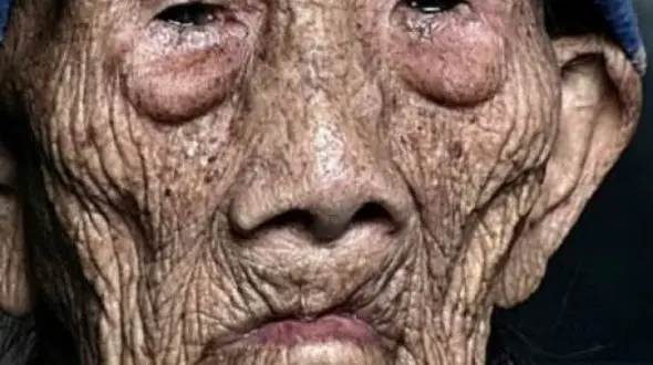 مردی  شبیه کروکودیل شد و مُرد + عکس